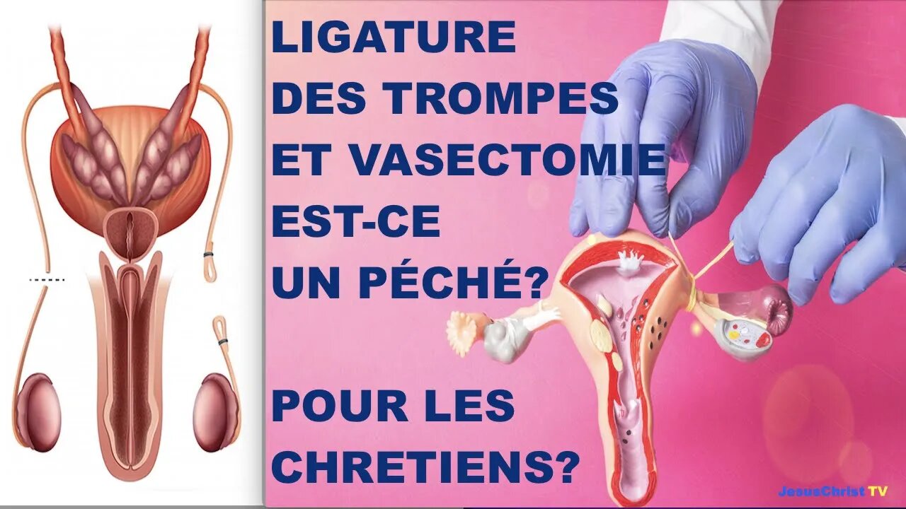 EST-CE PÉCHER POUR UNE FEMME DE SE LIGATURER LES TROMPES? Réponse de Georges~Témoignage de Conforte