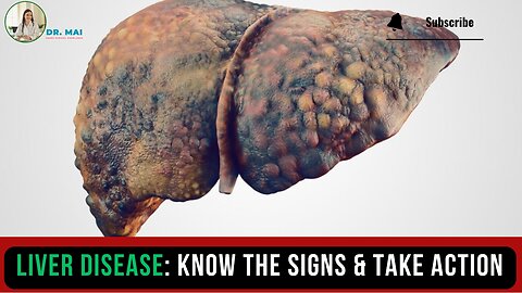 What is One of The First Signs of Liver Disease? | DR. MAI