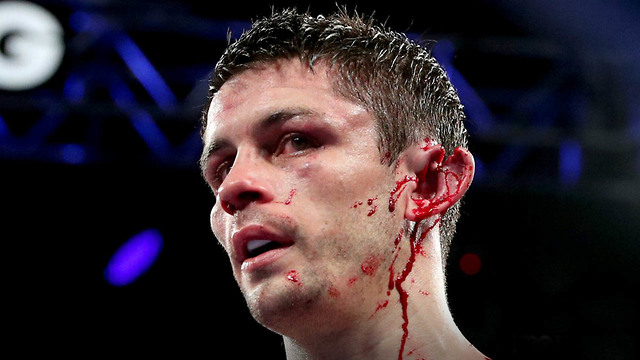 OUCH! Boxer Stephen Smith Gets Ear RIPPED in Half During Head Collision