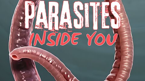 Shocking Parasite Facts: Are You Infected Without Knowing It? | EP 130