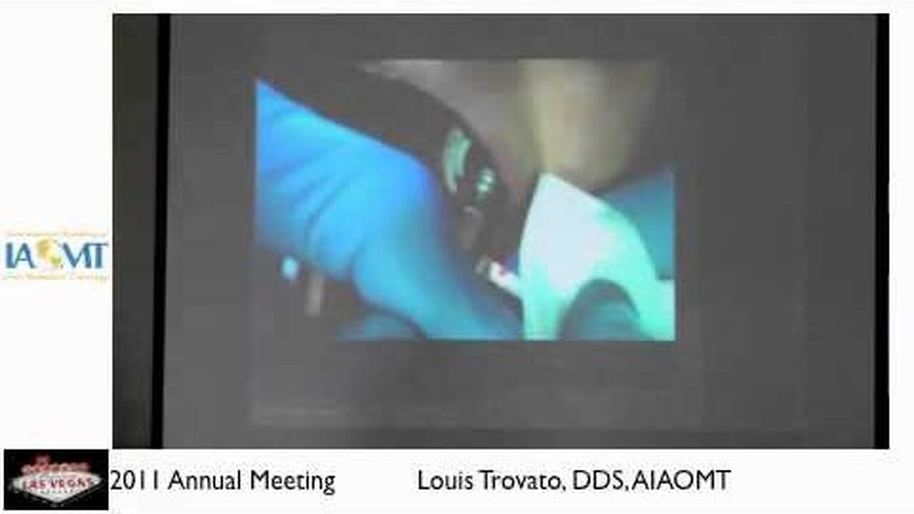 Louis Travato DDS. discusses Atraumatic Tooth Extractions IAOMT 2011 Las Vegas