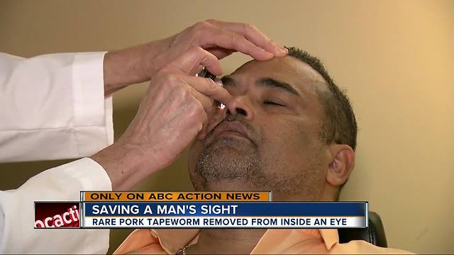 Exclusive: Brain-eating worm grows in Florida man’s eye