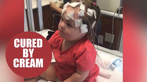 Baby girl who couldn't smile cured by whipping cream