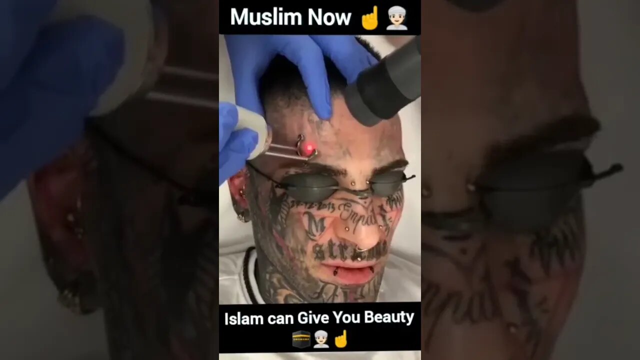 Allahu Akbar, after Revert to Islam, he Remove tattoos from face 🧔 #tattoo #converttoislam #shorts