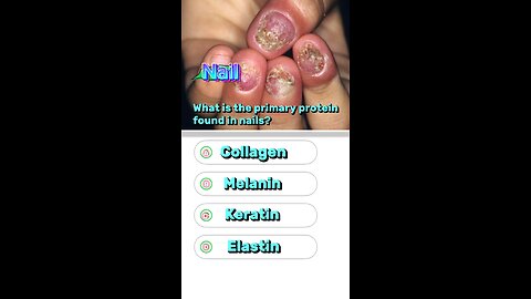 Nails question answer mcqs : 🙏💅anatomy of nails #nailsdiseasessigns #lungsdisease #quiz