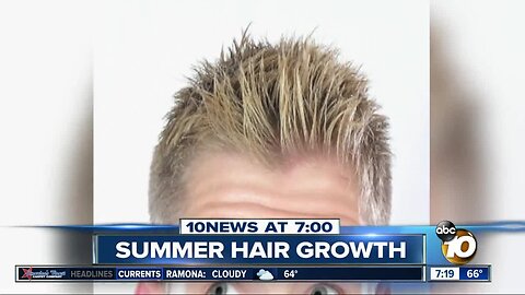 Hair grows faster in the Summer?