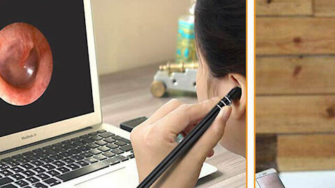 3-in-1 USB Ear Cleaning Endoscope HD Visual Ear Spoon Multifunctional Earpick With Mini Camera