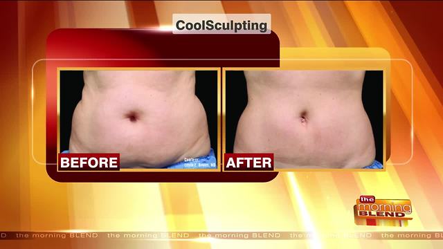 Removing Fat without Surgery or Downtime