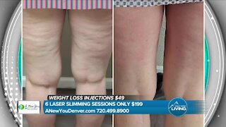 Laser Slimming Treatments // A New You