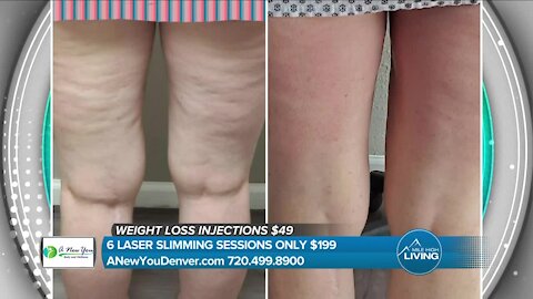 Laser Slimming Treatments // A New You