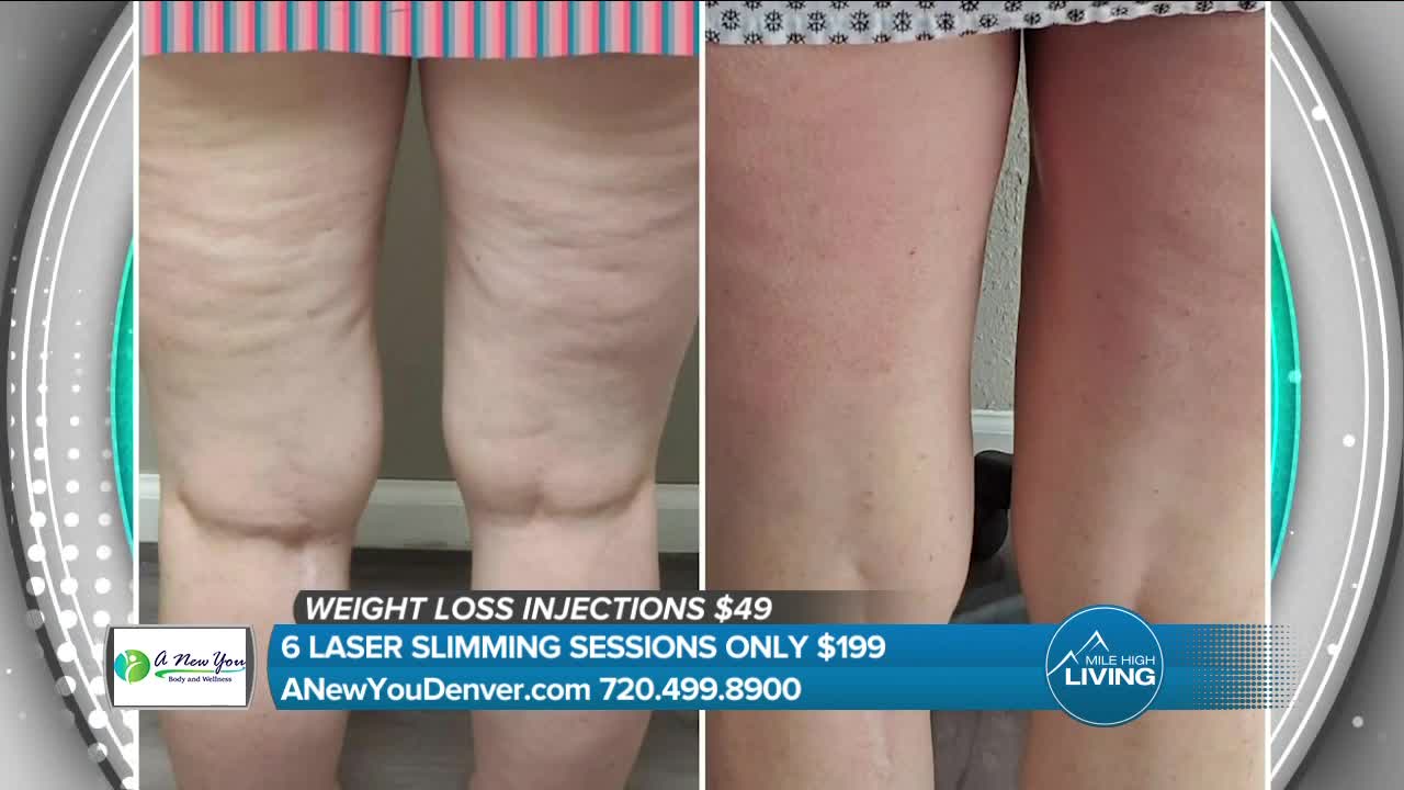 Laser Slimming Treatments // A New You