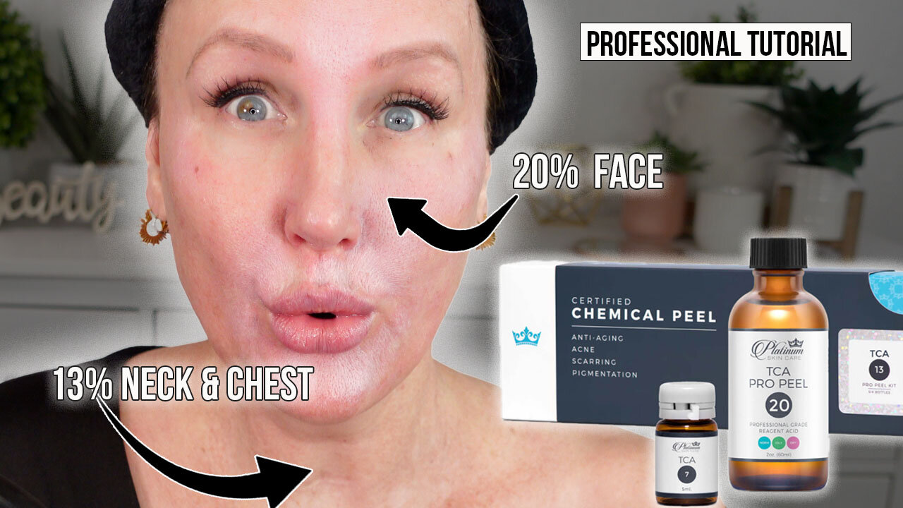 TCA Peel Tutorial // Face + Neck + Chest + Shoulders