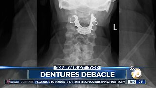 Missing dentures found in man's throat?