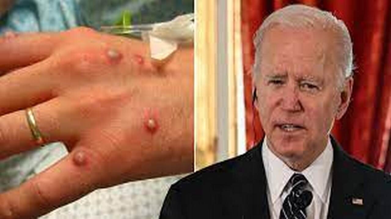 Biden less popular than Monkey Pox!