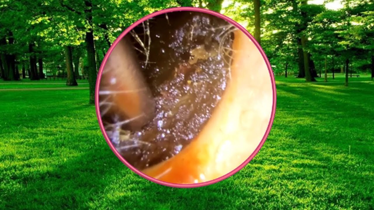 Ear Cleaning with Relaxing Music #09