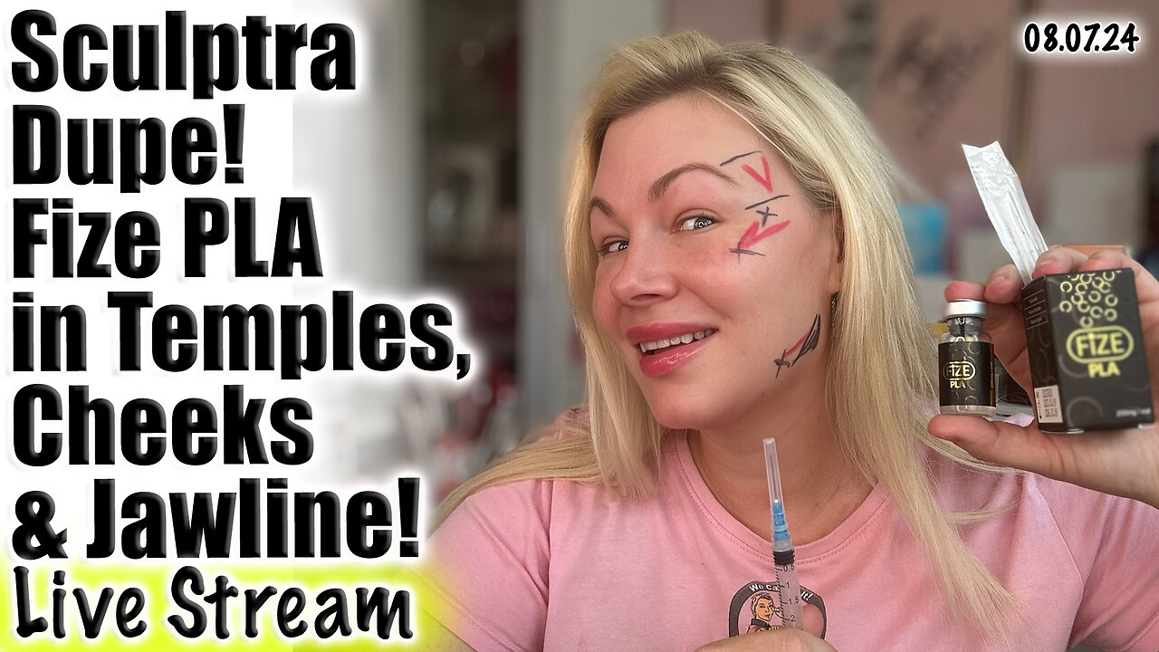 Live SCULPTRA DUPE! Fize PLA To treat the Temples, Cheeks and Jawline w/ Cannula! Acecosm