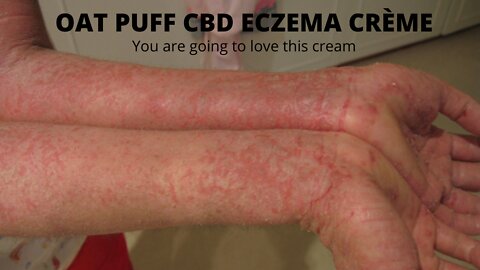 OAT PUFF CBD ECZEMA CRÈME