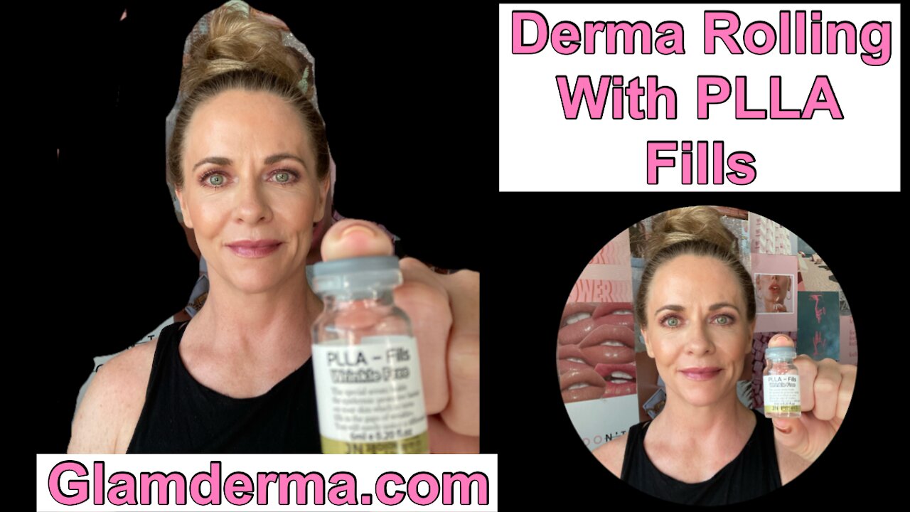 Derma Rolling with PLLA Fills from Glamderma | Plump Up Wrinkles | Use Code LBV10