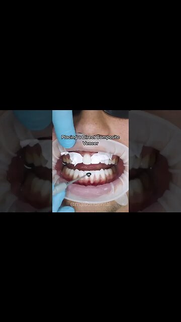 Dental And Teeth Hygiene