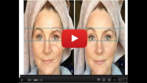 “At-Home Botox” Secret Soon To Leave Plastic Surgeons Jobless