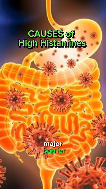 Why would someone have such high histamines?