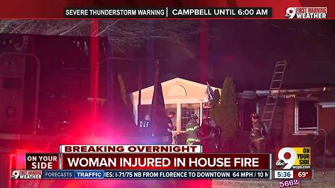 Woman injured in Columbia Township house fire