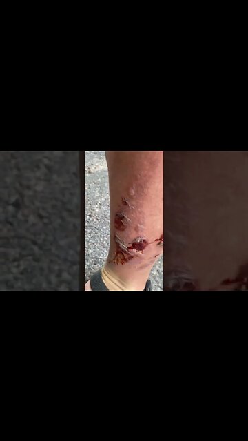 PSA - Why you don’t throw gas on a fire