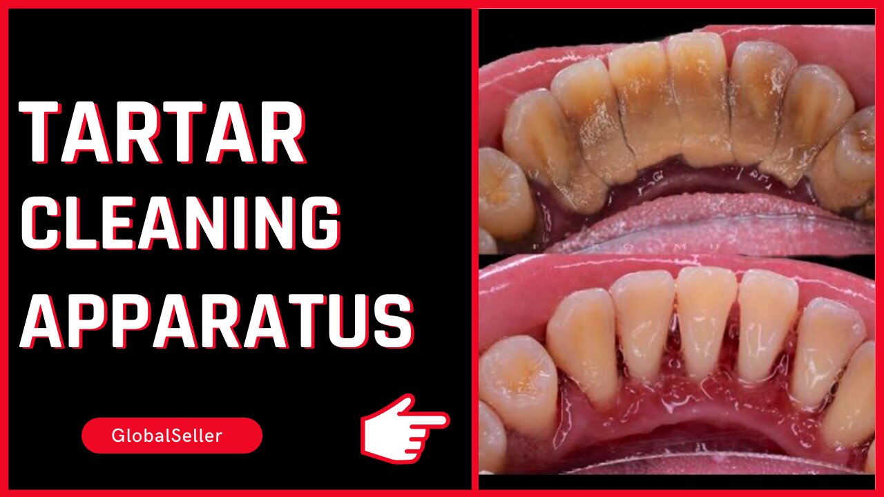 Tartar and Oral Hygiene Plaque Cleaning Apparatus