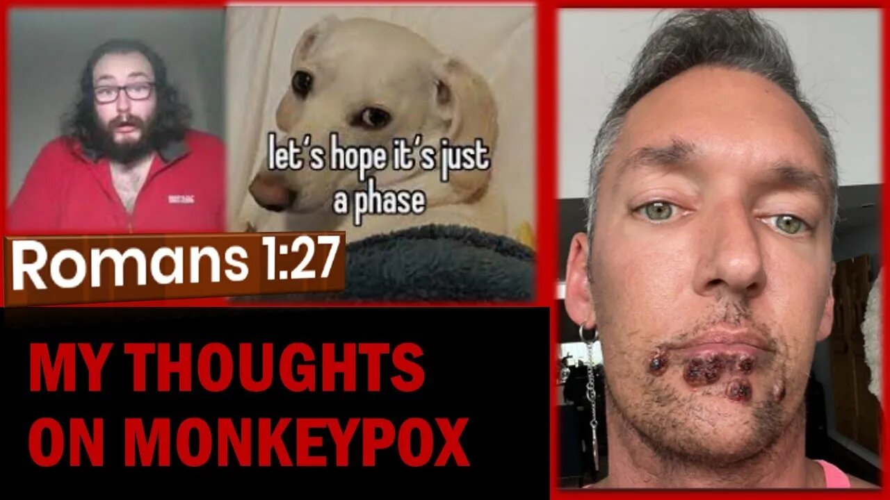 My Thoughts on MonkeyPox