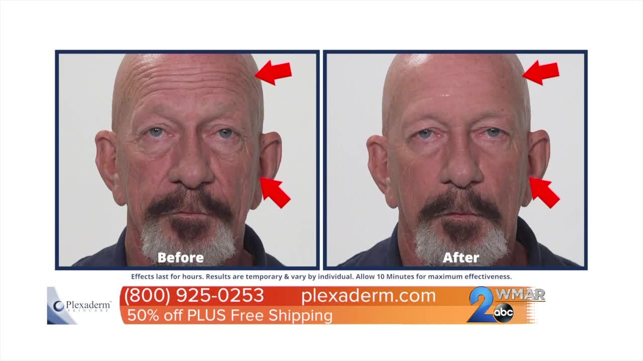 Feel and look younger with Plexaderm