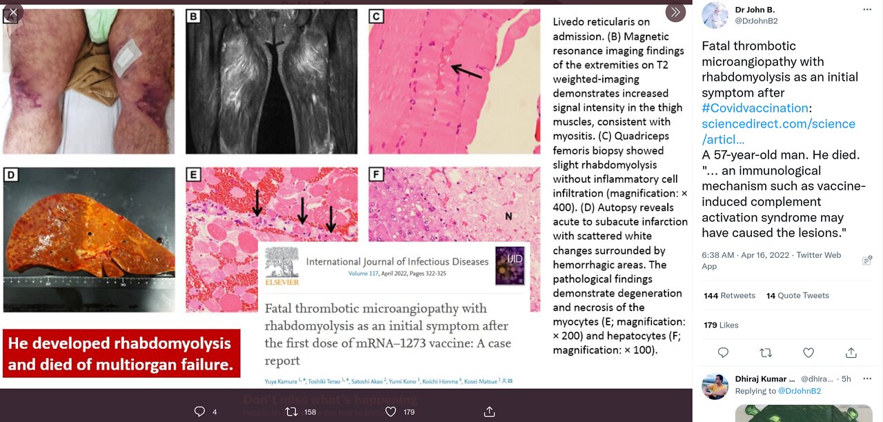 [VAX GENOCIDE] DrJohnB2 on Twitter