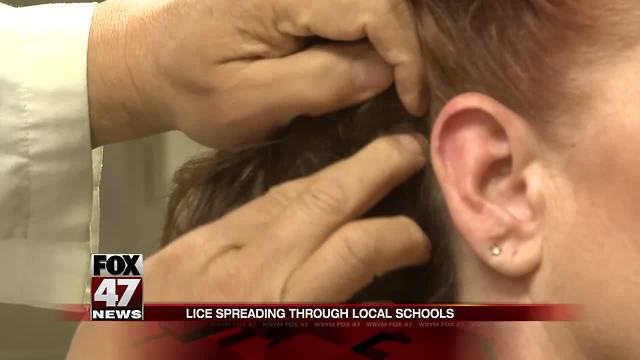 Lice spreading in Mid-Michigan schools