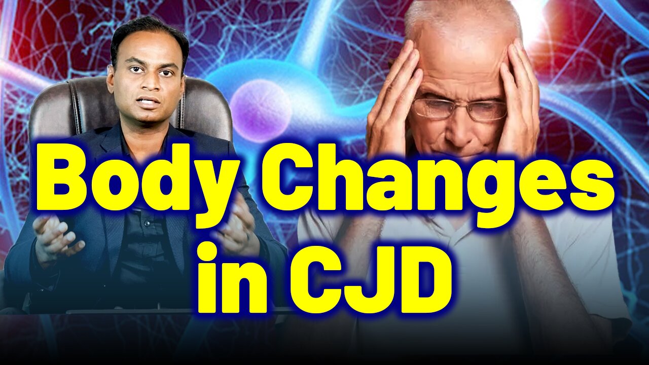 Changes in the body due to CJD, Creutzfeldt Jakob Disease, Prion Disease, Mad Cow, CWD .