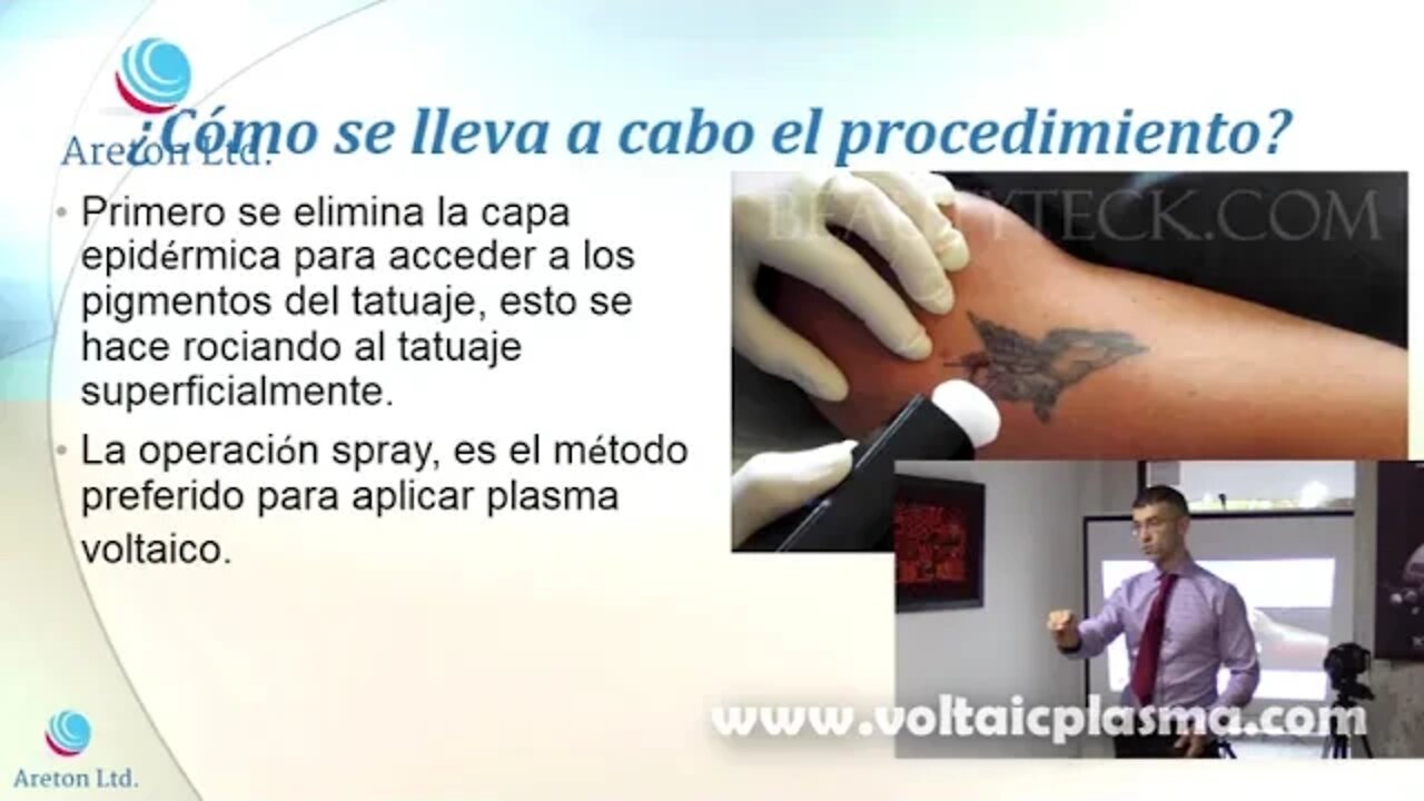 CASO ESTUDIO DE ELIMINACIÓN DE TATUAJE