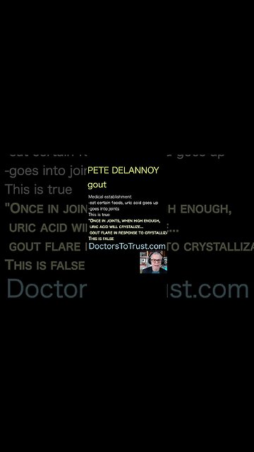 Pete Delannoy. In joints, when high, uric acid crystalizes: flare is response: this is false