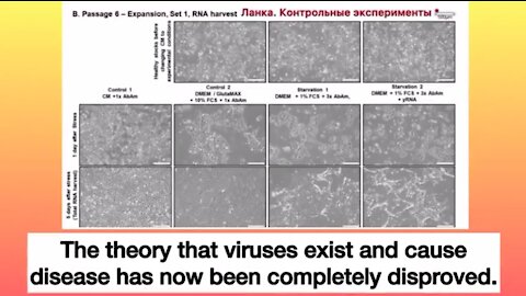 The Final Refutal Of Virology. Please Share.