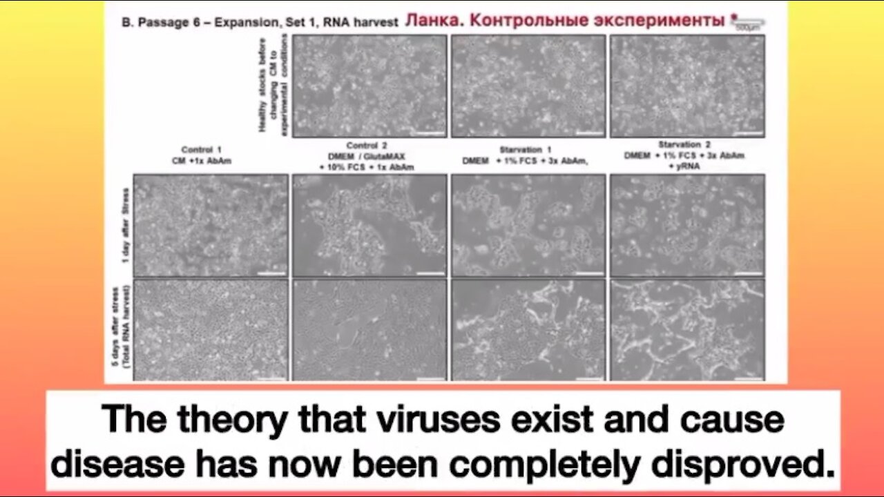 The Final Refutal Of Virology. Please Share.