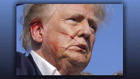 Trump's Head Wound