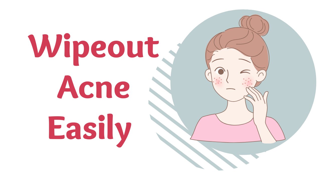 Abolish Acne Easily