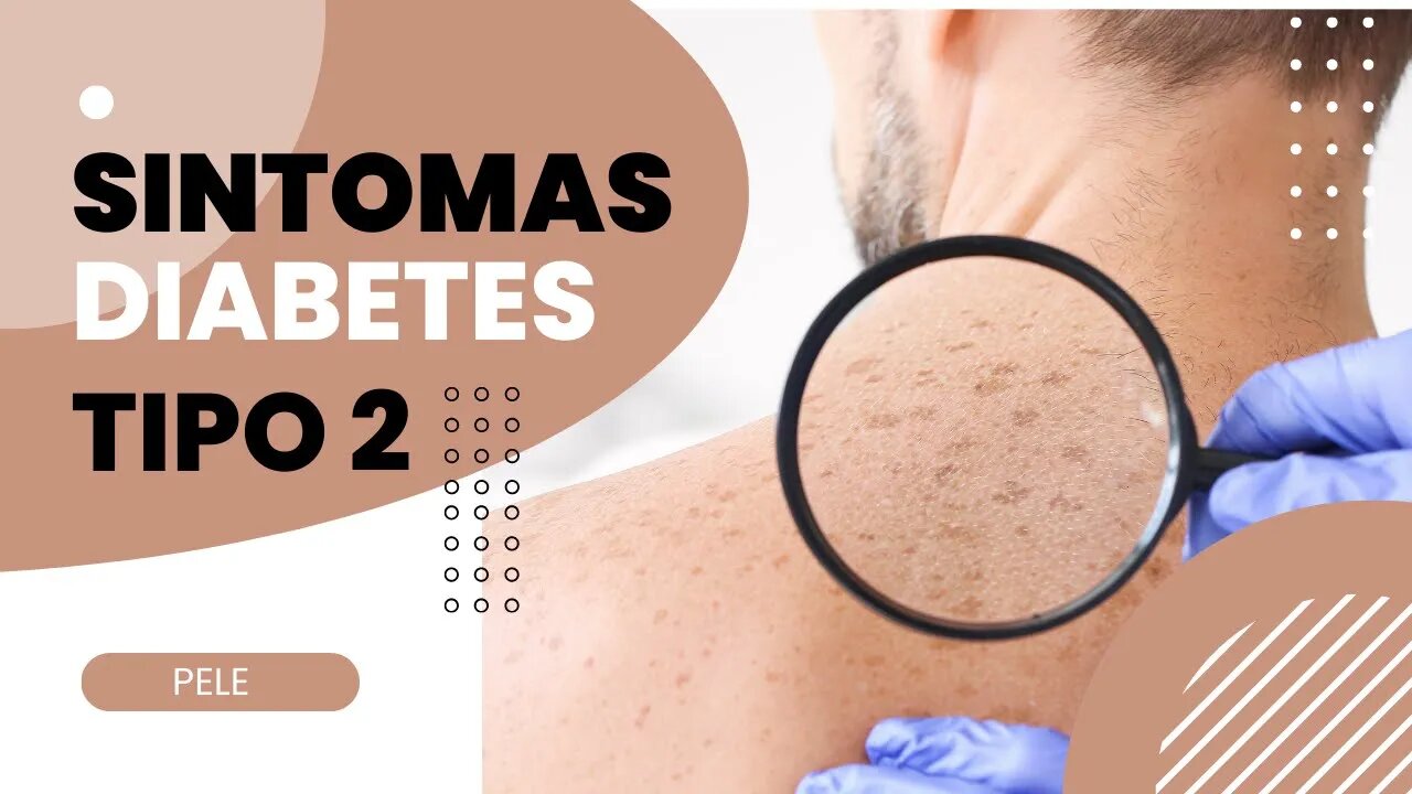 Sintomas de Diabetes Tipo 2 [ Pele ] Parte 3