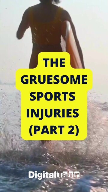 PART 2: Top 10 Gruesome Sports Injuries #shorts