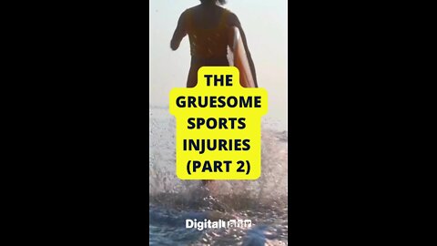 PART 2: Top 10 Gruesome Sports Injuries #shorts