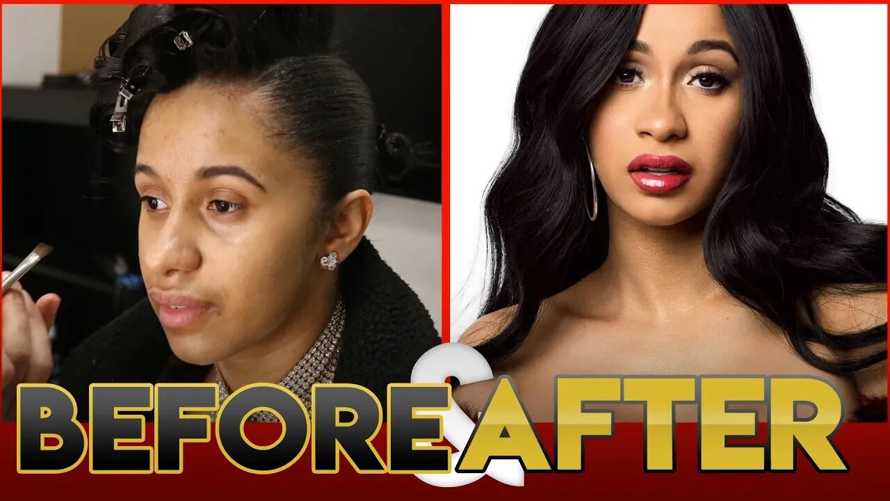 CARDI B | BEFORE & AFTER TRANSFORMATION ( Plastic Surgery )