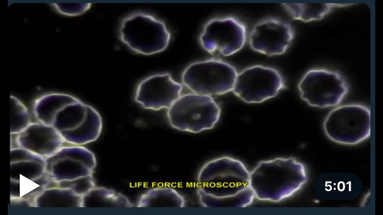 LIVE BLOOD ANALYSIS: ENDOBIOSIS Part 5