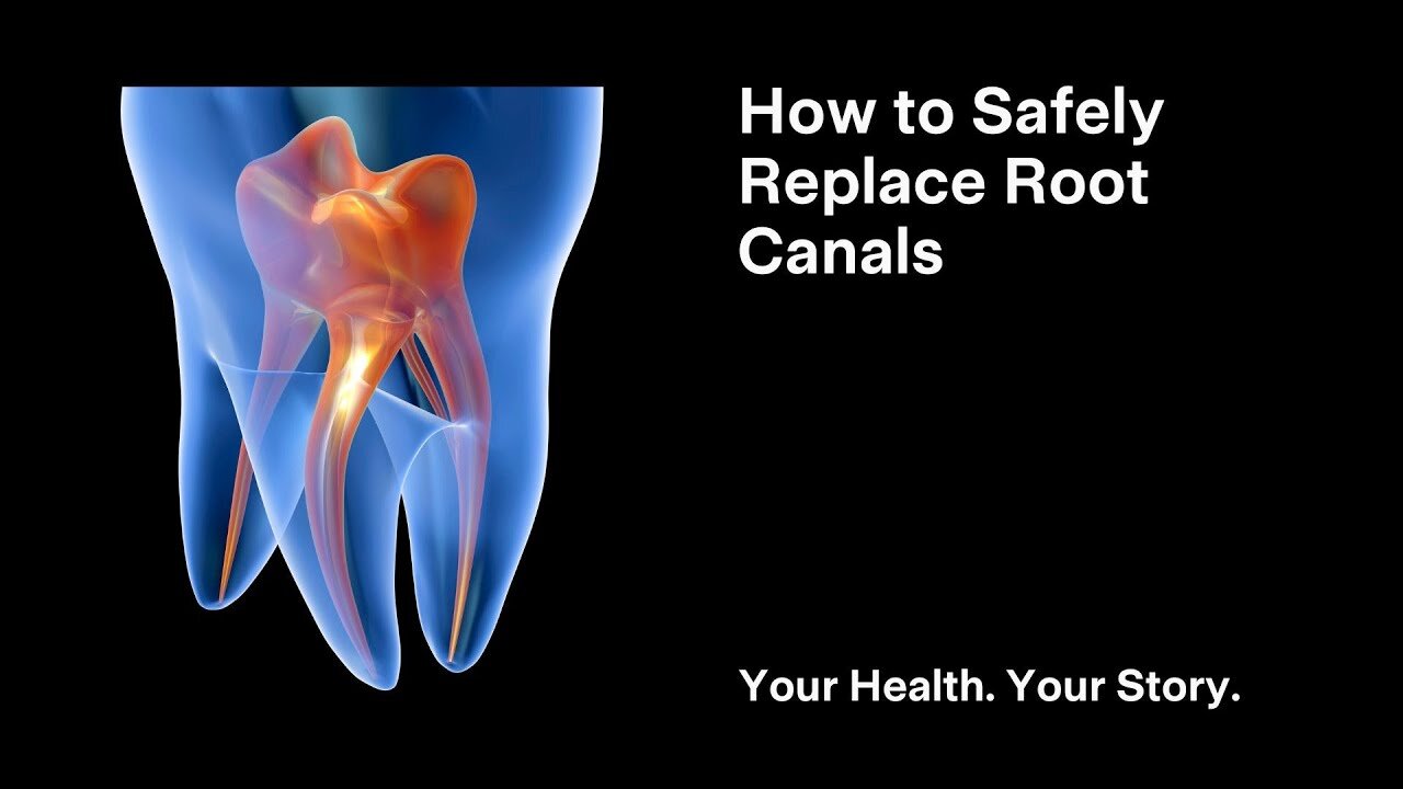 How to Safely Replace Root Canals