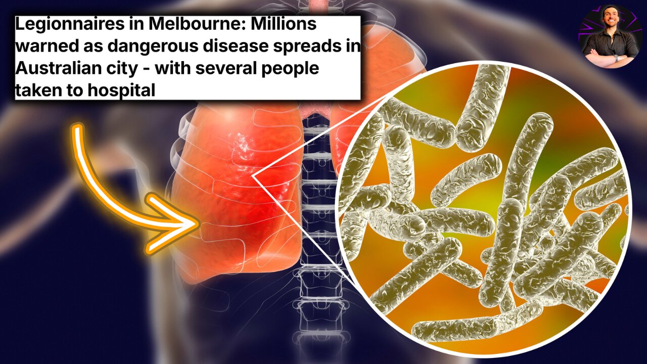 Legionnaires Disease is Making a HUGE Comeback in Melbourne! Know the Signs and STAY SAFE!