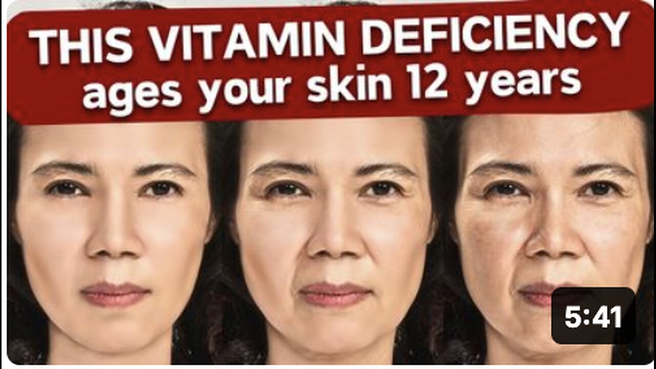 This Vitamin Deficiency Is Aging Your Skin Fast