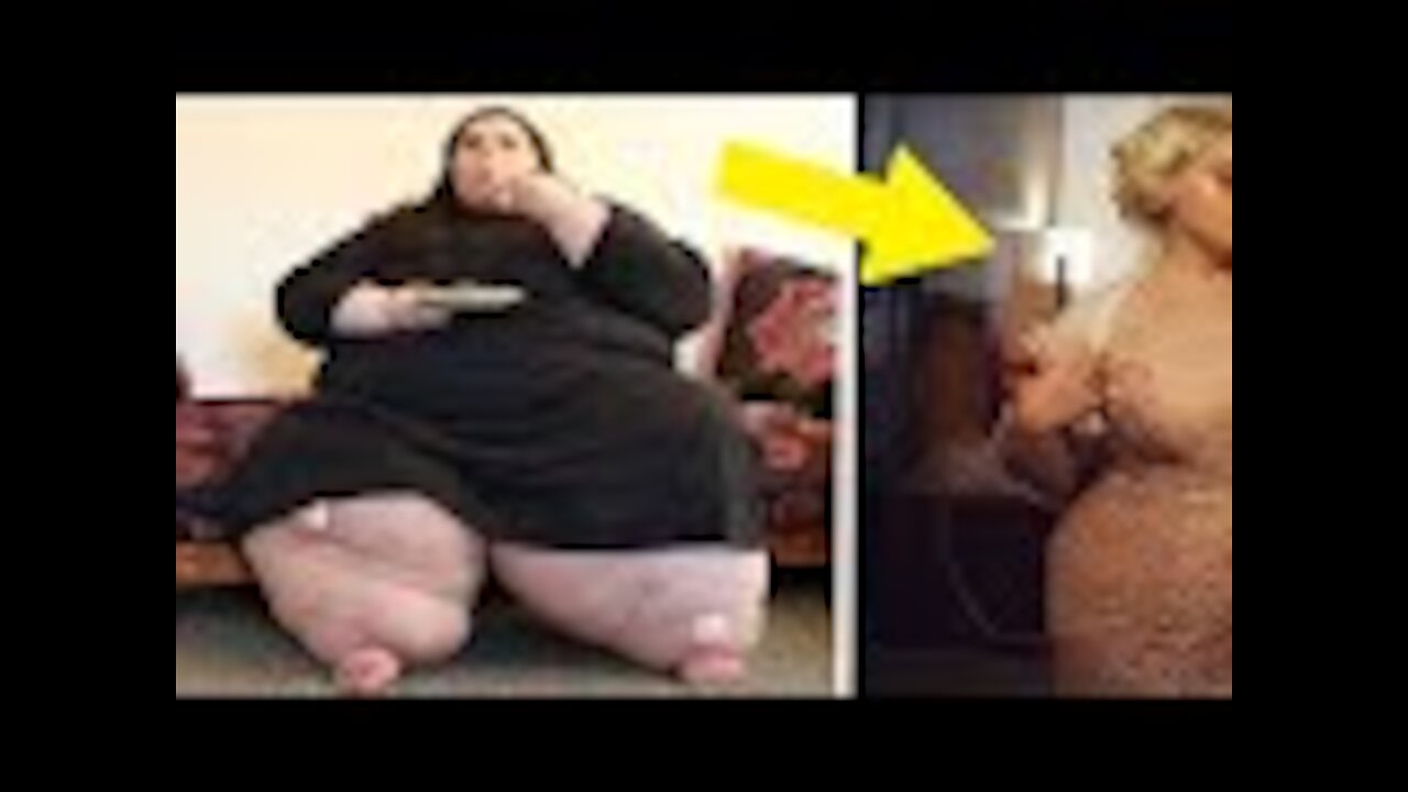 You Won’t Believe The Amazing “After” Photos From My 600 LB Life