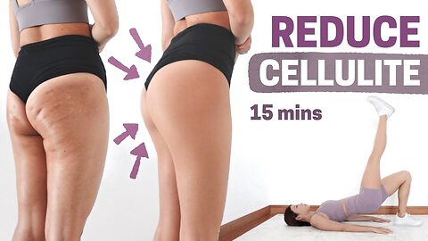 How to Get Rid Of Cellulite On Thighs, Legs and Butt