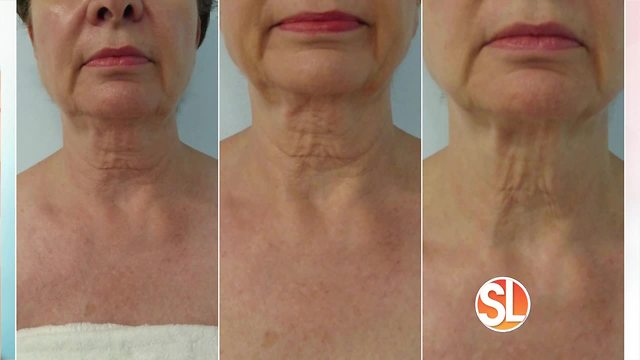 Turn Back Time Spa & Wellness Clinic treat sagging skin